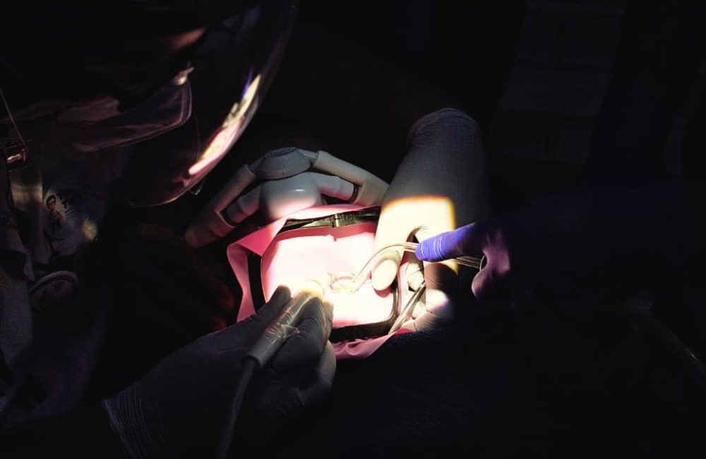 Tooth tales clinic - Greater Noida - Root Canal Treatment